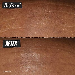 Fast Release Retinol Serum - Wrinkle-Reducing Night Serum